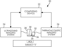 METHOD AND SYSTEM FOR MONITORING TISSUE TEMPERATURE