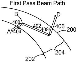 SECOND PASS FEMTOSECOND LASER FOR INCOMPLETE LASER FULL OR PARTIAL THICKNESS CORNEAL INCISIONS