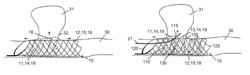 Medical device and system having such a device