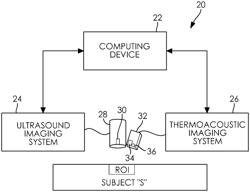 SYSTEM FOR MONITORING TISSUE TEMPERATURE