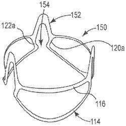 Stents for prosthetic heart valves and methods of making same