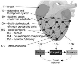 DISTRIBUTED NEUROMORPHIC COMPUTING FOR HIGH DEFINITION BIOELECTRIC DIAGNOSTICS AND THERAPY