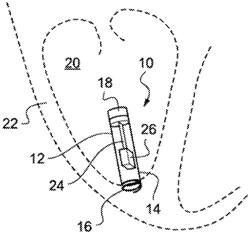 Leadless Autonomous Cardiac Capsule with Rotatably-Mounted Piezoelectric Energy Harvester