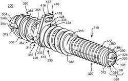 Implants and methods of use and assembly