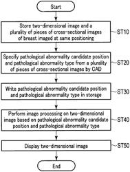 X-ray diagnostic apparatus and image processing apparatus to specify a position of a pathological abnormality candidate