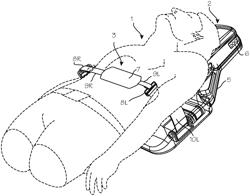 Automated Chest Compression Device