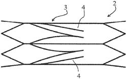 Vascular filter device