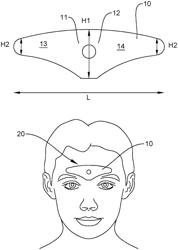 Device for the Transcutaneous Electrical Stimulation of the Trigeminal Nerve