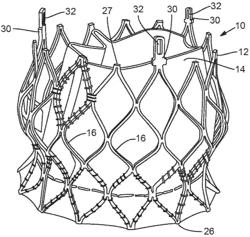 PROSTHETIC HEART VALVE