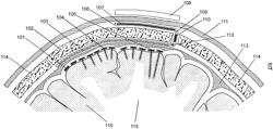 Implantable Neural Interface