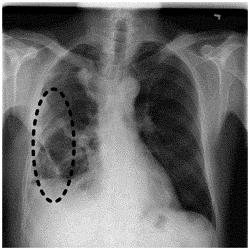 MEDICAL IMAGE ASSESSMENT WITH CLASSIFICATION UNCERTAINTY