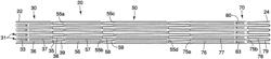 STENT STRUCTURES FOR USE WITH VALVE REPLACEMENTS