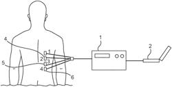 DEVICES AND METHODS FOR RESPIRATORY VARIATION MONITORING BY MEASUREMENT OF RESPIRATORY VOLUMES, MOTION AND VARIABILITY