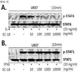 COMPOSITION CONTAINING MONOACETYLDIACYLGLYCEROL COMPOUND AS ACTIVE INGREDIENT FOR INHIBITING BLOOD CANCER OR METASTASIS