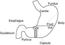 Method and Apparatus for Gastric Examination Using a Capsule Camera