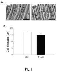 Muscular atrophy-inducing agent using hypometabolism-inducing substance T1AM, and use thereof in treating muscular hypertrophy