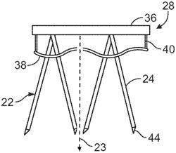 Electroporation apparatus and method of using same for ablation of an arbitrary volume