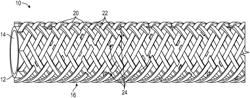 Segmented MRI catheters and other interventional devices