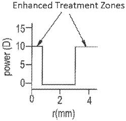 High plus treatment zone lens design and method for preventing and/or slowing myopia progression