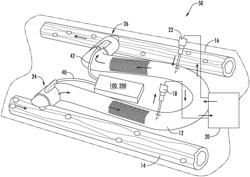 Magnetically Activated Arteriovenous Access Valve System and Related Methods