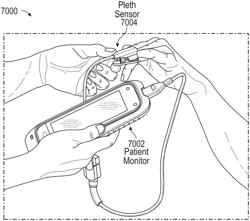 Spot check measurement system