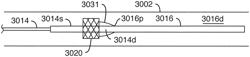 Scaffold loading and delivery systems