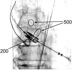 Automatic movement detection