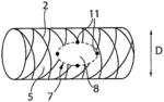 Bioresorbable stent