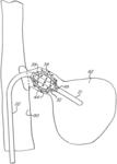 Nasal delivery of agents with nested balloon catheter