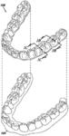 Dental materials using thermoset polymers