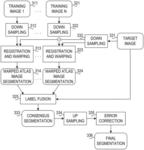 Template based anatomical segmentation of medical images