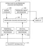 Non-invasive estimation of intravascular pressure changes using vector velocity ultrasound (US)