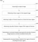 Systems and methods for displaying a medical image