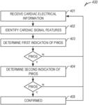 IDENTIFYING P WAVE OVERSENSING