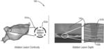 ULTRASOUND BASED THREE-DIMENSIONAL LESION VERIFICATION WITHIN A VASCULATURE