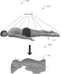 SYSTEMS AND METHODS FOR DESIGNING AND MANUFACTURING CUSTOM IMMOBILIZATION MOLDS FOR USE IN MEDICAL PROCEDURES