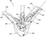 SYSTEMS AND METHODS FOR INTRA-PROCEDURAL CARDIAC PRESSURE MONITORING