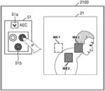 Medical imaging apparatus and method of operating same