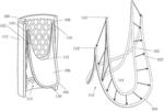 Geometrically-accommodating heart valve replacement device
