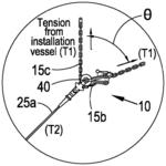 Mooring tensioner and methods thereof