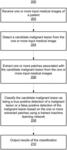 REDUCING FALSE POSITIVE DETECTIONS OF MALIGNANT LESIONS USING MULTI-PARAMETRIC MAGNETIC RESONANCE IMAGING