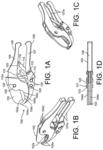 System and method for extraction and cryopreservation of bone marrow