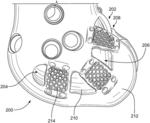 Systems and methods for attaching soft tissue to an implant