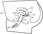 Vaginal Drug Delivery Device and Vaginal Diagnostic Device