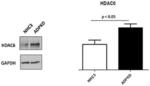 URSODEOXYCHOLIC ACID DERIVATIVES FOR THE TREATMENT OF POLYCYSTIC DISEASES