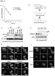 Pharmaceutical composition for preventing or treating aging-related diseases containing decursin derivative as active ingredient