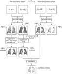 METHOD FOR PROCESSING COMPUTED TOMOGRAPHY IMAGING DATA OF A SUSPECT'S RESPIRATORY SYSTEM