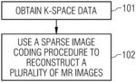 Method of reconstructing magnetic resonance image data