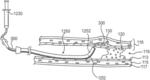 ENDOVASCULAR DEVICES AND METHODS FOR EXPLOITING INTRAMURAL SPACE