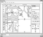 Adaptive navigation technique for navigating a catheter through a body channel or cavity